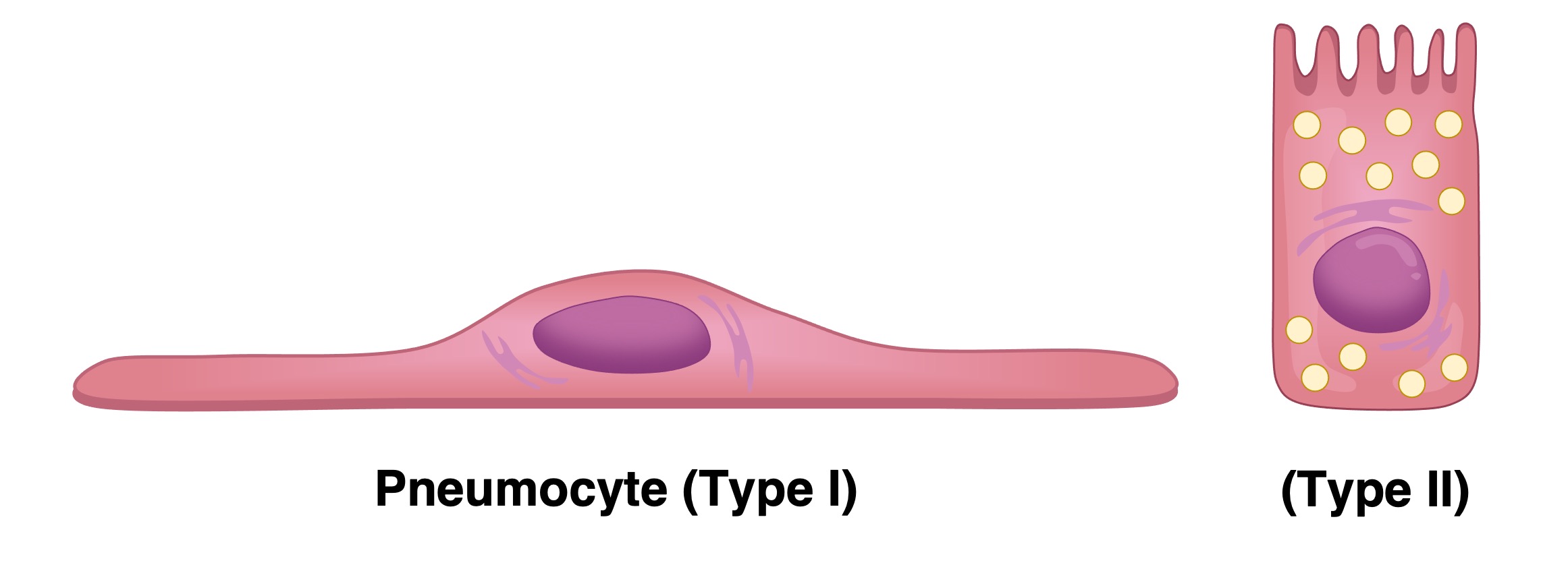 pneumocyte