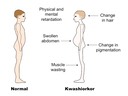 Option A: Human Nutrition and Health