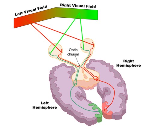 contralateral processing