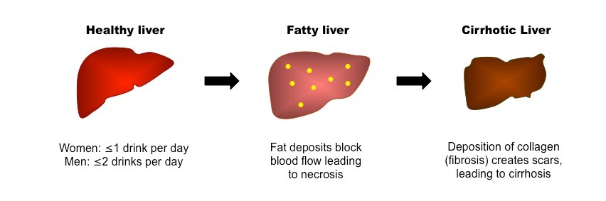 liver damage