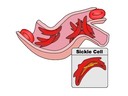 4.1 Chromosomes, Genes, Alleles and Mutations