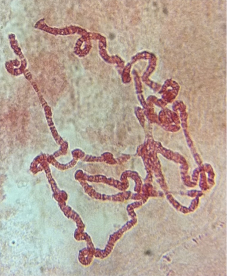 DNA%20eukaryote