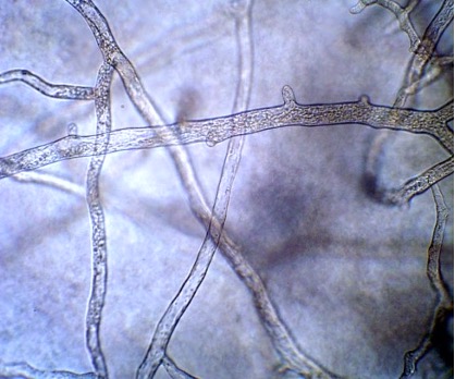 fungal%20hyphae