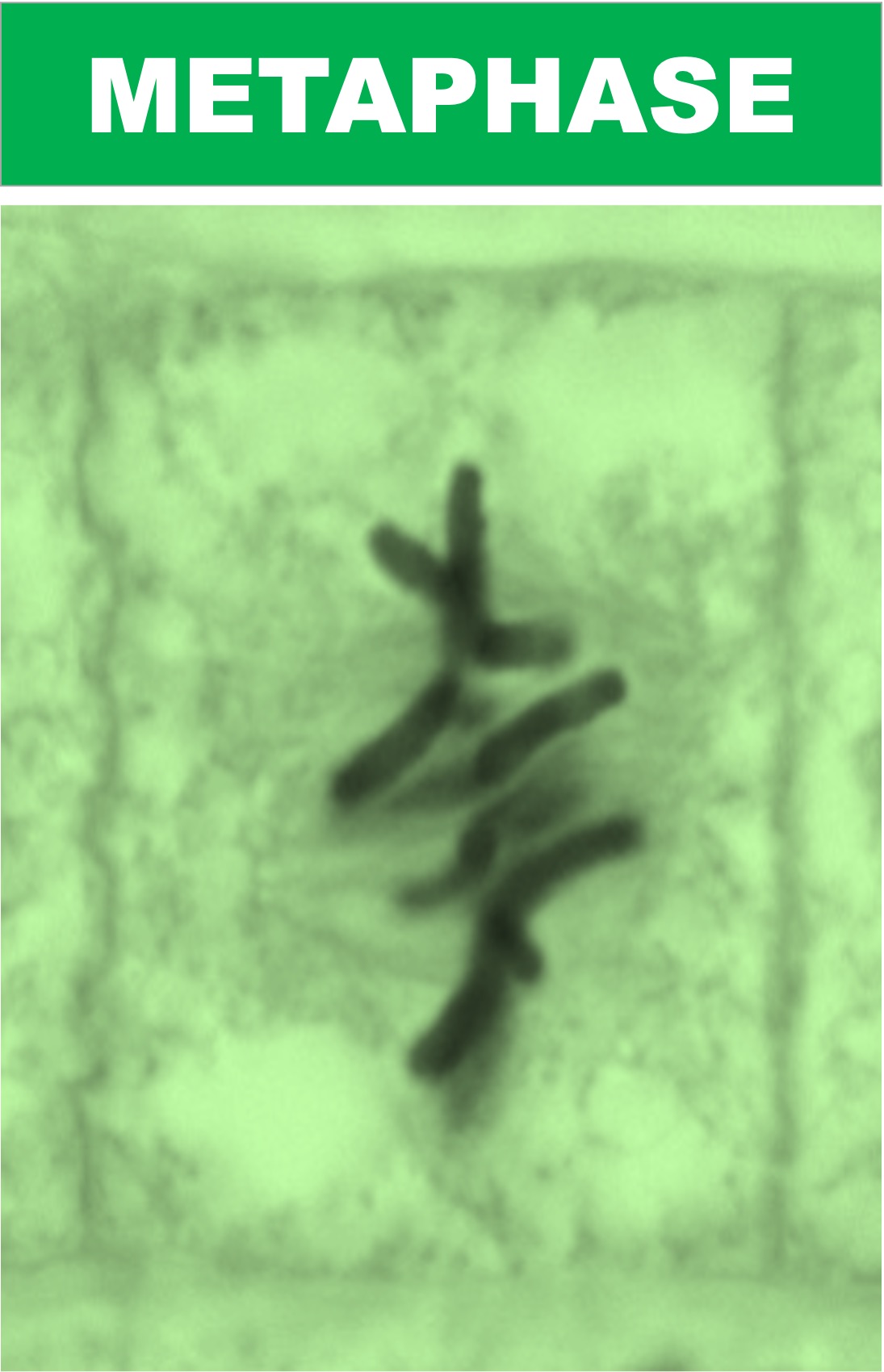 metaphase%20micrograph