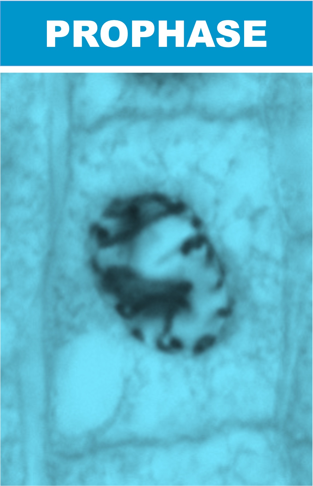 prophase%20micrograph