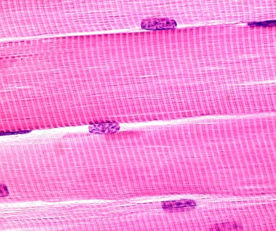 skeletal%20muscle
