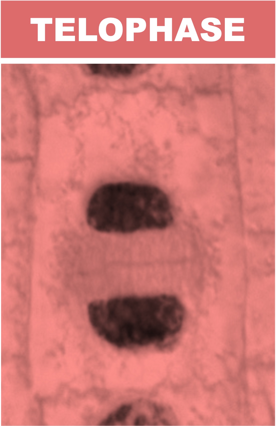 telophase%20micrograph